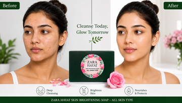 ZARA HAYAT Skin Brightening Soap for Acne, Pimples & Glowing Skin | All Skin Types