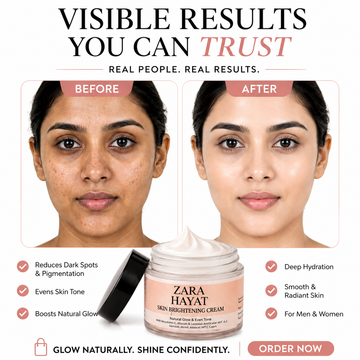 Zara Hayat Skin Brightening Cream – Natural Glow &amp; Dark Spot Treatment